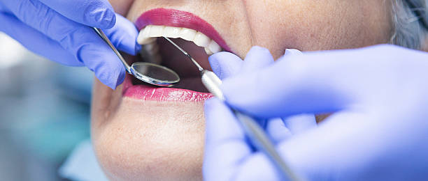 Best Emergency Gum Treatment in Ford City, CA
